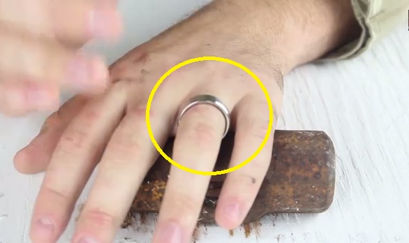 How To Remove A Tungsten Ring Stuck On Your Finger
