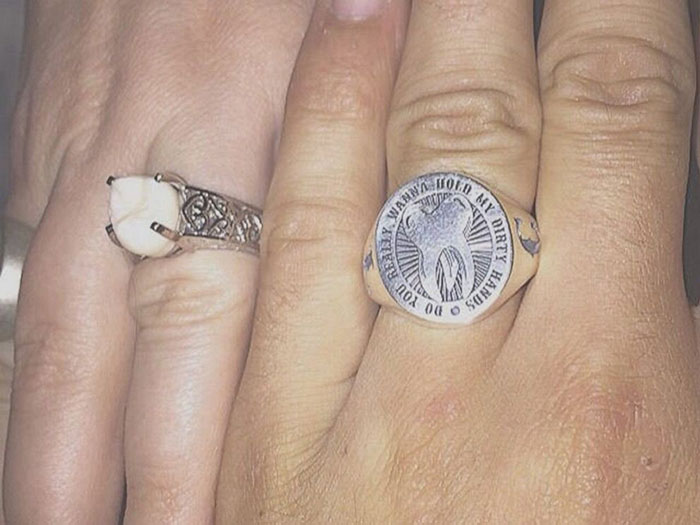 Hilarious Guy Proposes To Her Girlfriend Using A Ring With His Own Wisdom Tooth In It, You Might Scratch Your Head With This…