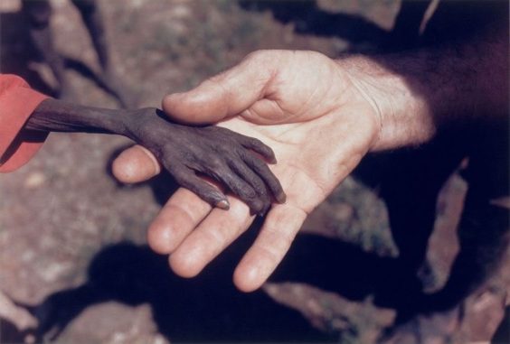1-starving-boy-and-missionary